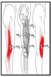 Knee Pain Richmond Podiatrist